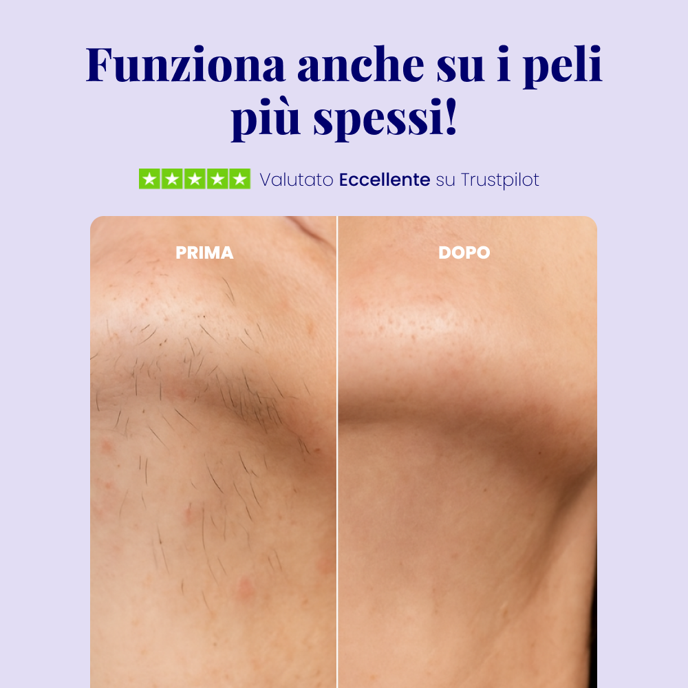 Velis Epil Pro™