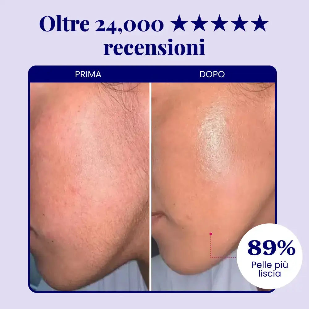 Velis Epil Pro™