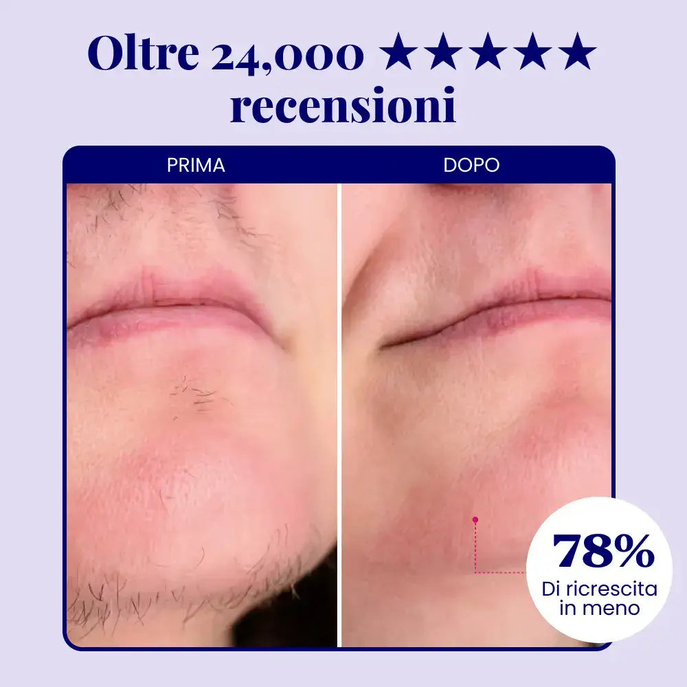 Velis Epil Pro™